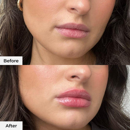 Instant Lip Plumper